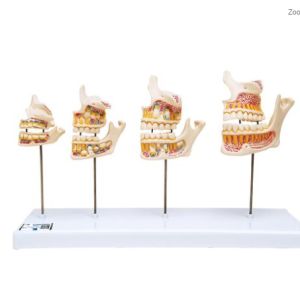 Modelo Anatómico do Desenvolvimento da Dentição