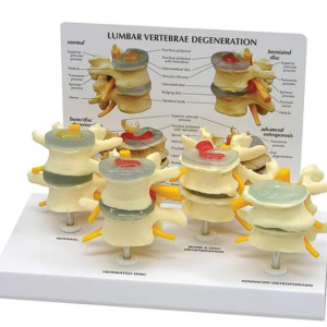 Conjunto de Modelo das Vértebras de 4 Estágios